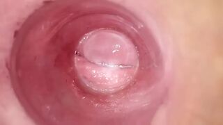 Having Fun with clear plug cervix watch
