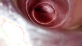 Having Fun with clear plug cervix watch