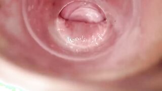 Having Fun with clear plug cervix watch