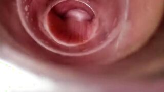 Having Fun with clear plug cervix watch