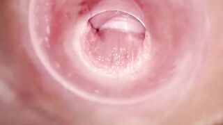 Having Fun with clear plug cervix watch