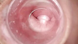 Having Fun with clear plug cervix watch