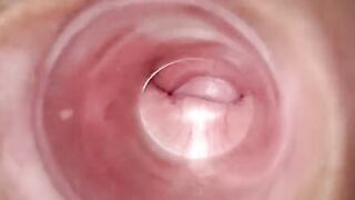 Having Fun with clear plug cervix watch