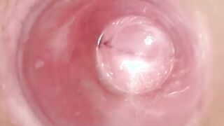 Having Fun with clear plug cervix watch