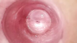 Having Fun with clear plug cervix watch