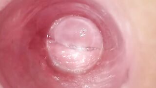 Having Fun with clear plug cervix watch