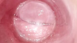 Having Fun with clear plug cervix watch