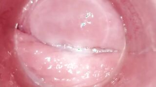Having Fun with clear plug cervix watch