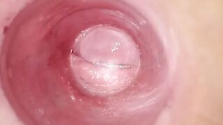 Having Fun with clear plug cervix watch