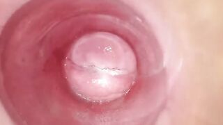 Having Fun with clear plug cervix watch