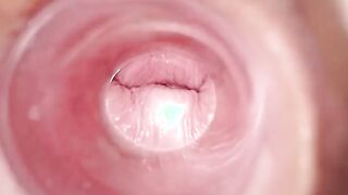 Having Fun with clear plug cervix watch
