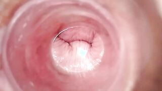 Having Fun with clear plug cervix watch