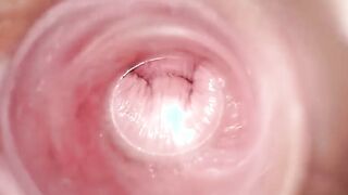 Having Fun with clear plug cervix watch
