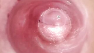 Having Fun with clear plug cervix watch