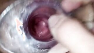 Having Fun with clear plug cervix watch