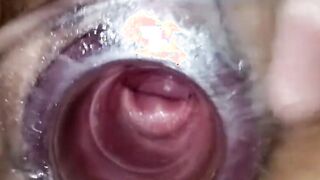 Having Fun with clear plug cervix watch