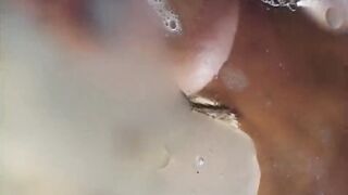 Vaginal Neglect #1