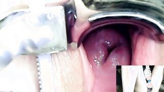 AdalynnX - Endoscope Speculum Hitachi Sex Toy Cum