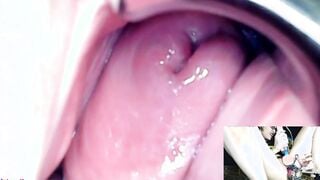 AdalynnX - Endoscope Speculum Hitachi Sex Toy Cum