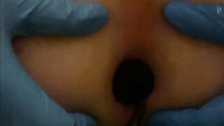 Sticky Micky’s Amateur anal vibrator fun part one