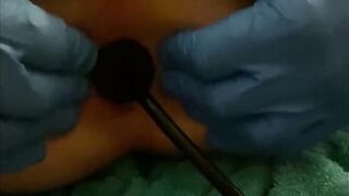 Sticky Micky’s Amateur anal vibrator fun part one
