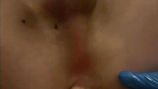 Sticky Micky Amateur anal toy fun part two