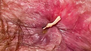 Insane Close Up Huge Clitoris Snatch Asshole Mouth Giantness Bondage Clip Unshaved Body !