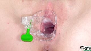 2 pervy doctors make young Bella Angel cum like dirty inside gyno chair