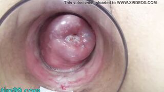 Japanese Mom Cervix Fucking with German real cock vibrator and oriental chopsticks