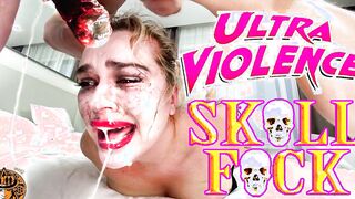 EXTREME SKULL BANGED WITH THE TOTAL DESTRUCTION OF THE PERSON