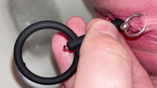 First time we use Vaginal Dilator for my Peeing