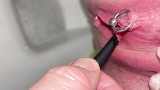 First time we use Vaginal Dilator for my Peeing