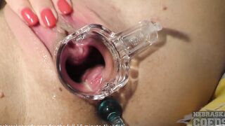 gyno play with Bae fresh chick