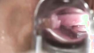 The naughty doctor gives a gorgeous baby anal treatment