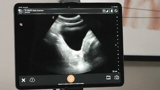 Gay teen Damien Grey gets his anal ultrasound