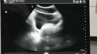 Gay teen Damien Grey gets his anal ultrasound