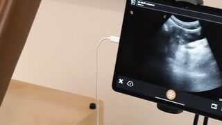 FunSizeBoys - Legrand Wolf uses ultrasound on tiny patient Shay Bake