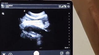 Tiny Tom Bentley have no choice but to watch his ass get drilled by Dr Wolf