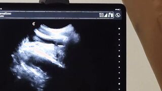 Tiny Tom Bentley have no choice but to watch his ass get drilled by Dr Wolf Hoe 2