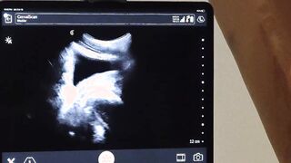 Tiny Tom Bentley have no choice but to watch his ass get drilled by Dr Wolf Hoe 2