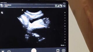 Tiny Tom Bentley have no choice but to watch his ass get drilled by Dr Wolf Hoe 2