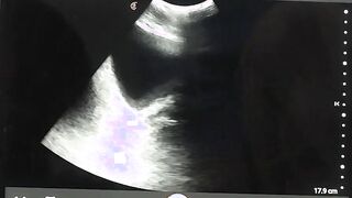 Gay Grant Ducati enjoy anal ultrasound with Doctor
