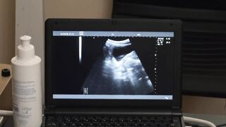 Austin Young and the doctor watched from the x-ray screen a bare cock throbbing in hi