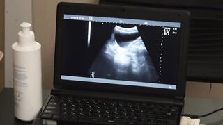 Austin Young and the doctor watched from the x-ray screen a bare cock throbbing in hi