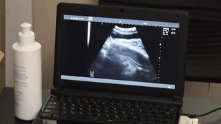 Austin Young and the doctor watched from the x-ray screen a bare cock throbbing in hi