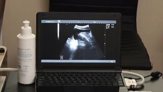 Austin Young and the doctor watched from the x-ray screen a bare cock throbbing in hi
