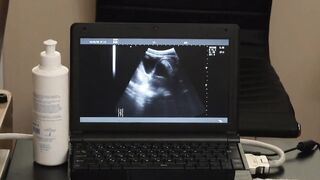 Austin Young and the doctor watched from the x-ray screen a bare cock throbbing in hi