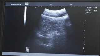 Dr Wolf got excited as Lucas Ryder releases a leak of pre-cum from his massive cock