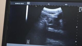 Dr Wolf got excited as Lucas Ryder releases a leak of pre-cum from his massive cock