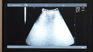 Dr Wolf watches the x-ray screen as he press his cock against Austin Young's hole